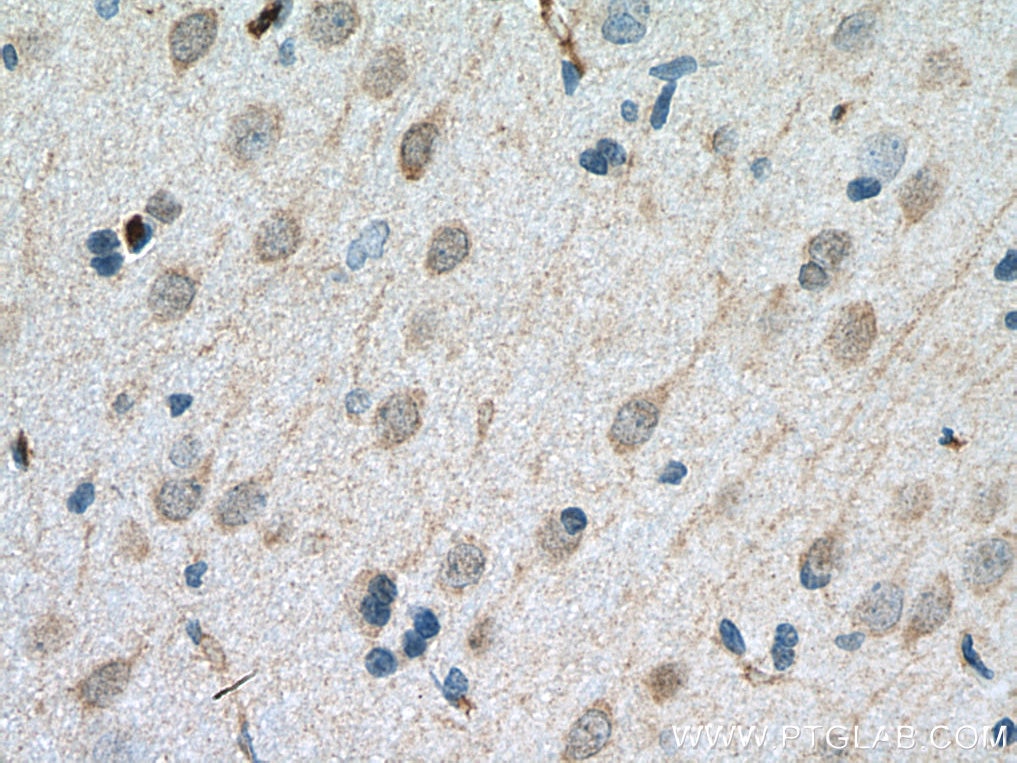 Immunohistochemistry (IHC) staining of rat brain tissue using DARPP32/PPP1R1B Polyclonal antibody (10748-1-AP)