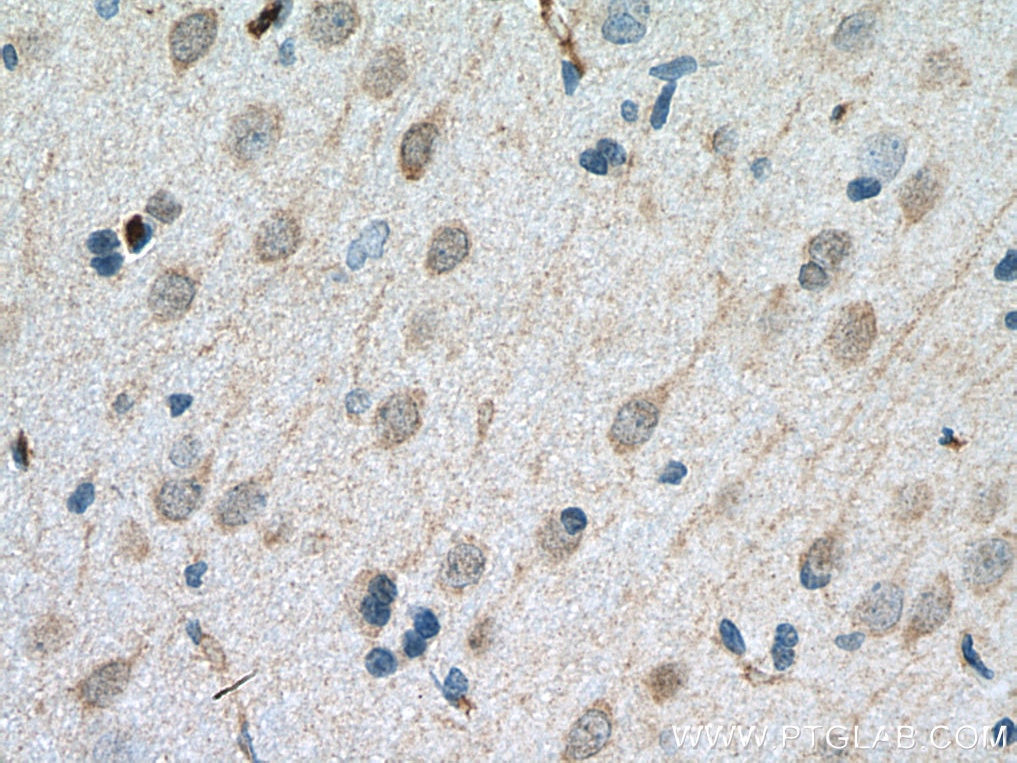 IHC staining of rat brain using 10748-1-AP