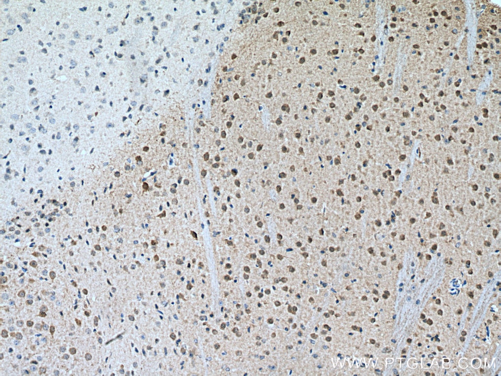 Immunohistochemistry (IHC) staining of mouse brain tissue using DARPP32/PPP1R1B Polyclonal antibody (10748-1-AP)
