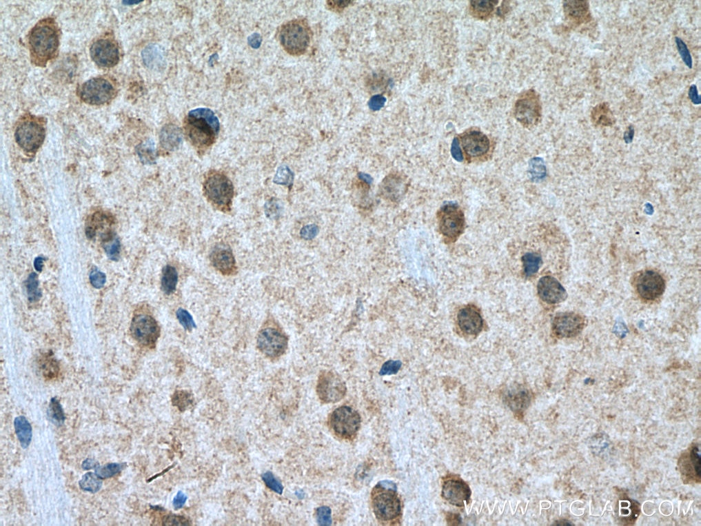 Immunohistochemistry (IHC) staining of mouse brain tissue using DARPP32/PPP1R1B Polyclonal antibody (10748-1-AP)