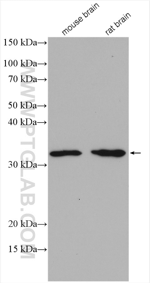 Western Blot (WB) analysis of various lysates using DARPP32/PPP1R1B Polyclonal antibody (10748-1-AP)
