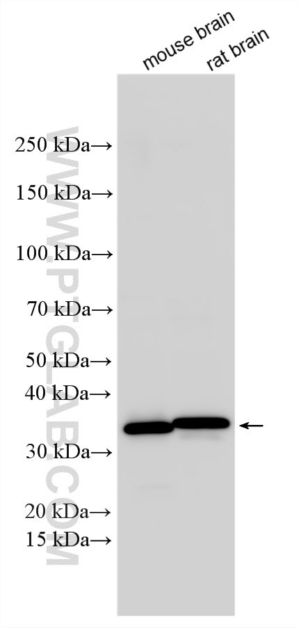 Various lysates were subjected to SDS PAGE followed by western blot with 10748-1-AP (DARPP32 antibody) at dilution of 1:2000 incubated at room temperature for 1.5 hours. Western Blot (WB) analysis of various lysates using DARPP32 Polyclonal antibody (10748-1-AP)