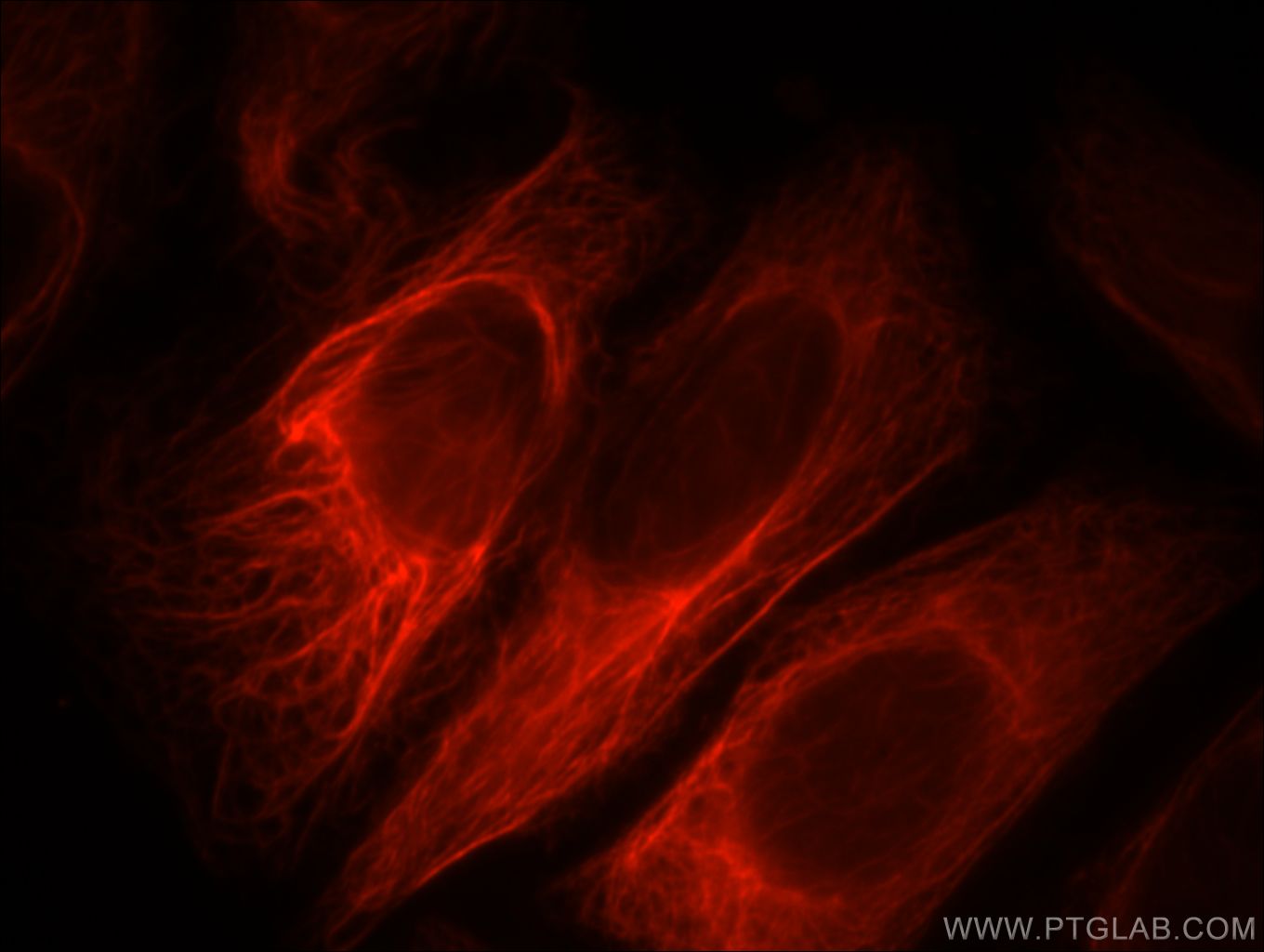 Immunofluorescence (IF) / fluorescent staining of HepG2 cells using PPP1R2P9 Polyclonal antibody (11969-1-AP)