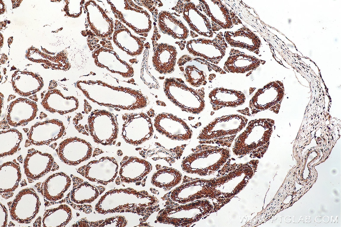 Immunohistochemistry (IHC) staining of mouse testis tissue using PPP1R2P9 Polyclonal antibody (11969-1-AP)