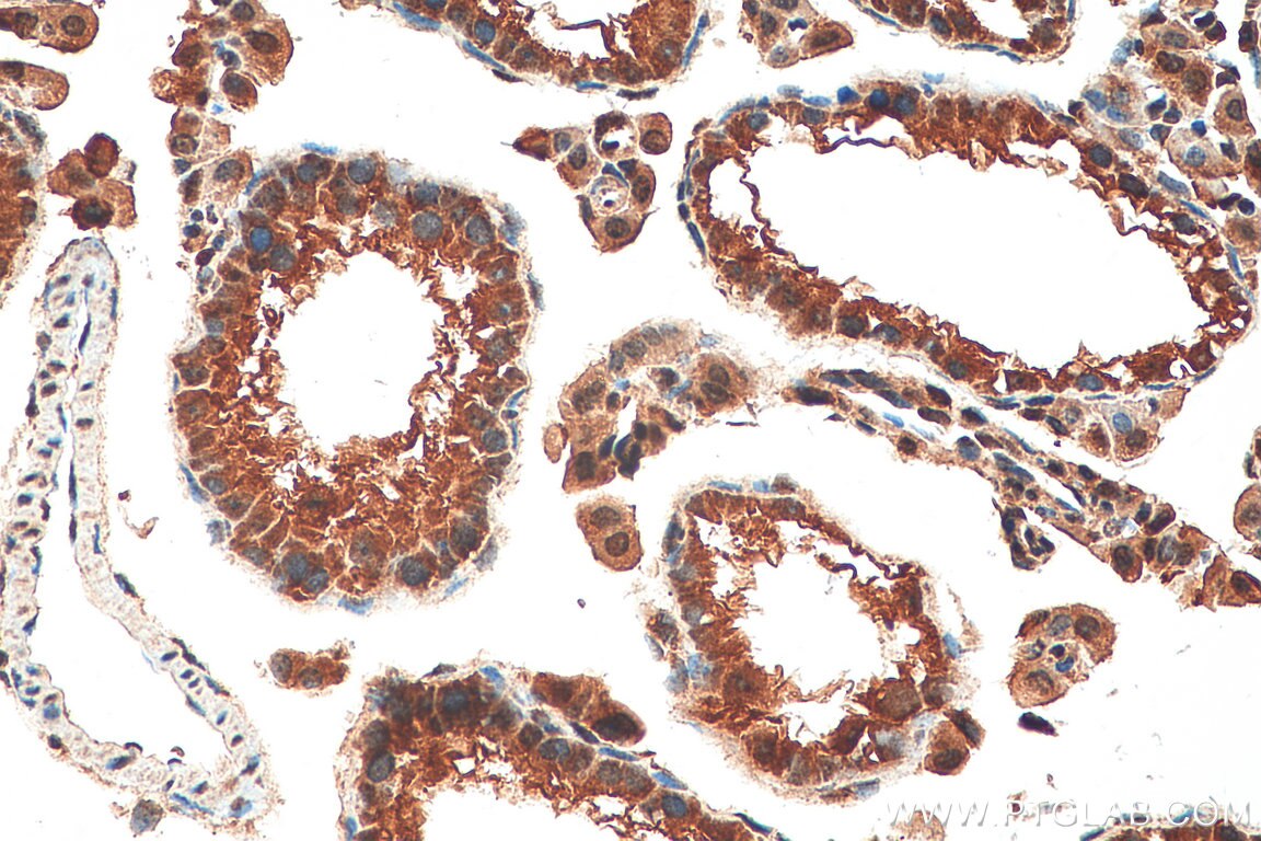 Immunohistochemistry (IHC) staining of mouse testis tissue using PPP1R2P9 Polyclonal antibody (11969-1-AP)