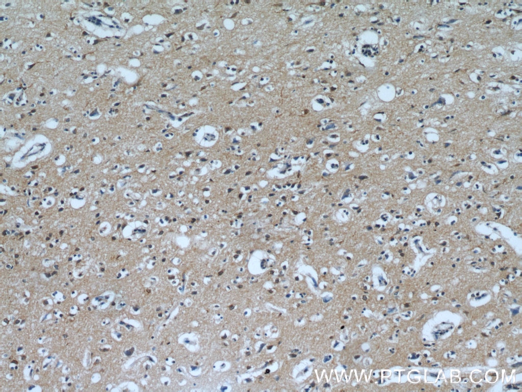 Immunohistochemistry (IHC) staining of human brain tissue using PPP1R2P9 Polyclonal antibody (11969-1-AP)