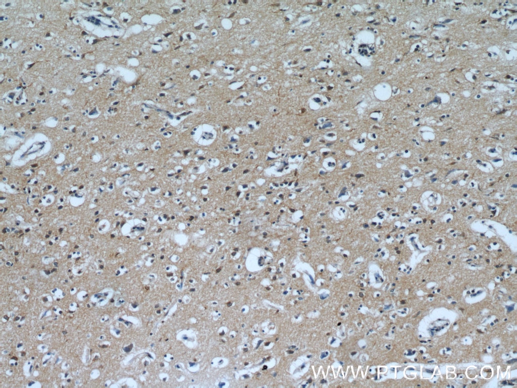 Immunohistochemistry (IHC) staining of human brain tissue using PPP1R2P9 Polyclonal antibody (11969-1-AP)