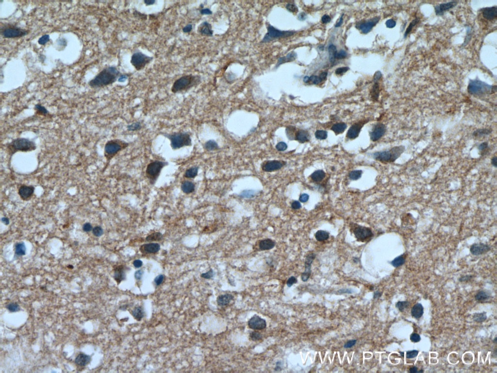 Immunohistochemistry (IHC) staining of human brain tissue using PPP1R2P9 Polyclonal antibody (11969-1-AP)