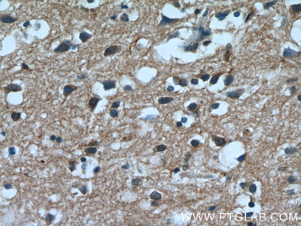 IHC staining of human brain using 11969-1-AP