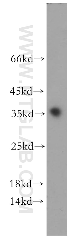 Western Blot (WB) analysis of human testis tissue using PPP1R2P9 Polyclonal antibody (11969-1-AP)