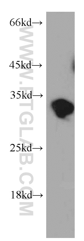 Western Blot (WB) analysis of human testis tissue using PPP1R2P9 Polyclonal antibody (11969-1-AP)