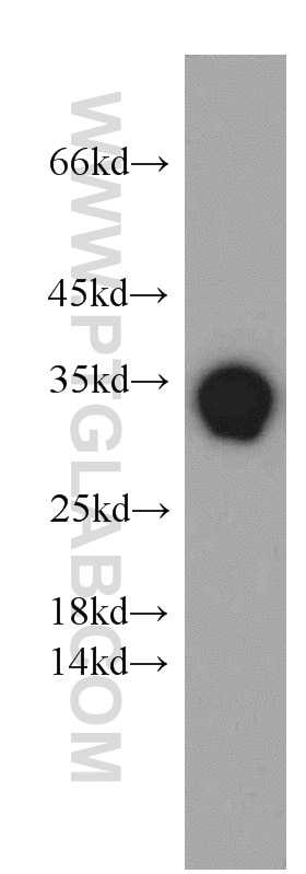 Western Blot (WB) analysis of human testis tissue using PPP1R2P9 Polyclonal antibody (11969-1-AP)