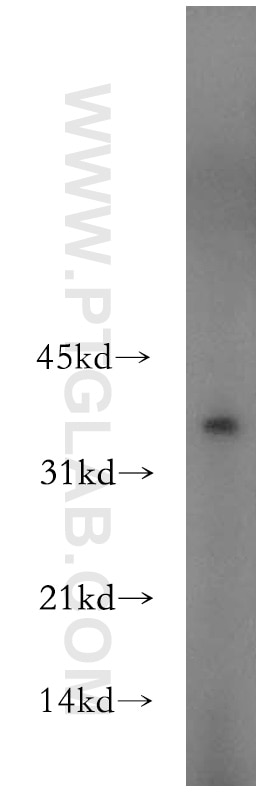 Western Blot (WB) analysis of human brain tissue using PPP1R2P9 Polyclonal antibody (11969-1-AP)