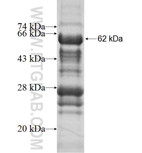 PPP1R2P9 fusion protein Ag2591 SDS-PAGE
