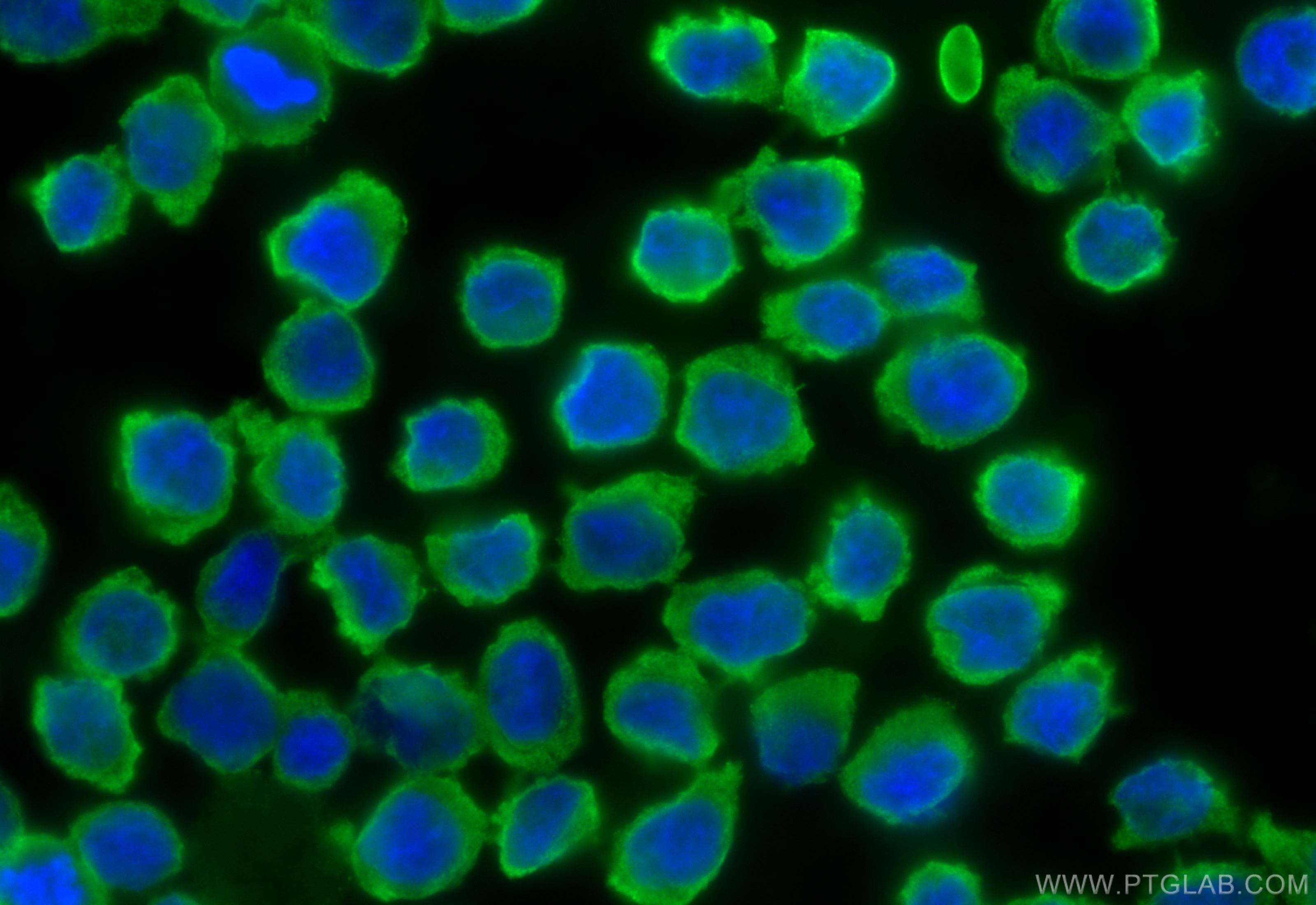 Immunofluorescence (IF) / fluorescent staining of THP-1 cells using PPP1R3A Polyclonal antibody (22495-1-AP)