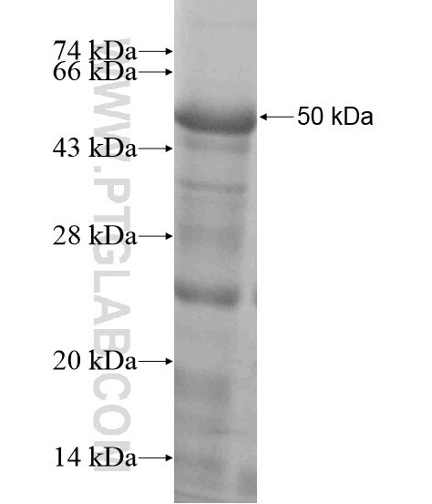 PPP1R3A fusion protein Ag19185 SDS-PAGE