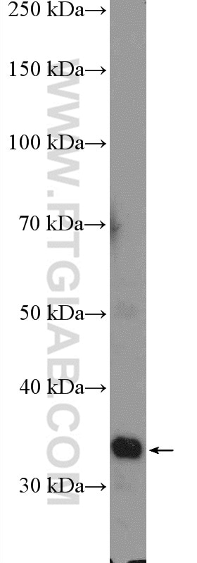 Western Blot (WB) analysis of mouse liver tissue using PPP1R3B Polyclonal antibody (14190-1-AP)
