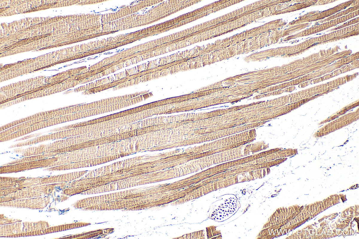 Immunohistochemistry (IHC) staining of mouse skeletal muscle tissue using PPP1R3B Polyclonal antibody (27285-1-AP)