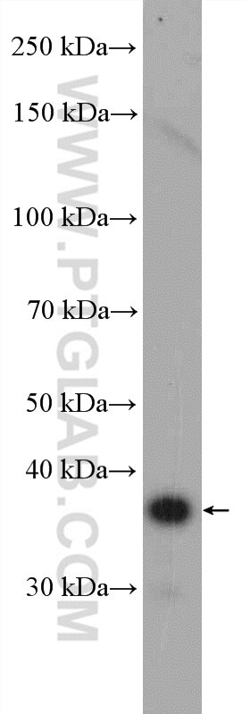 Western Blot (WB) analysis of MDA-MB-453s cells using PPP1R3B Polyclonal antibody (27285-1-AP)