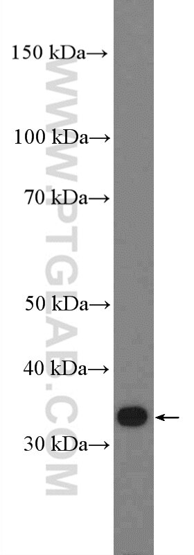 Western Blot (WB) analysis of mouse heart tissue using PPP1R3B Polyclonal antibody (27285-1-AP)