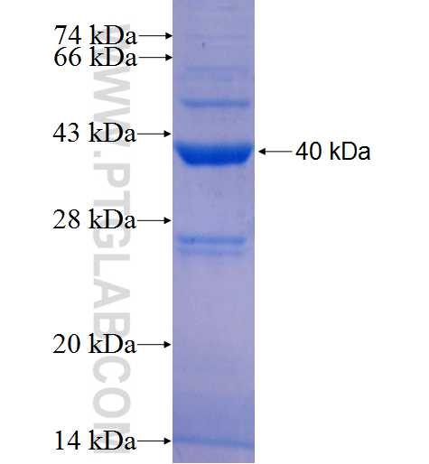 PPP1R3B fusion protein Ag26025 SDS-PAGE