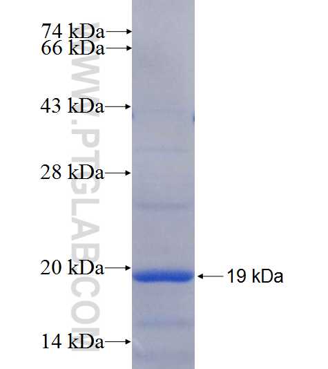PPP1R3B fusion protein Ag26033 SDS-PAGE