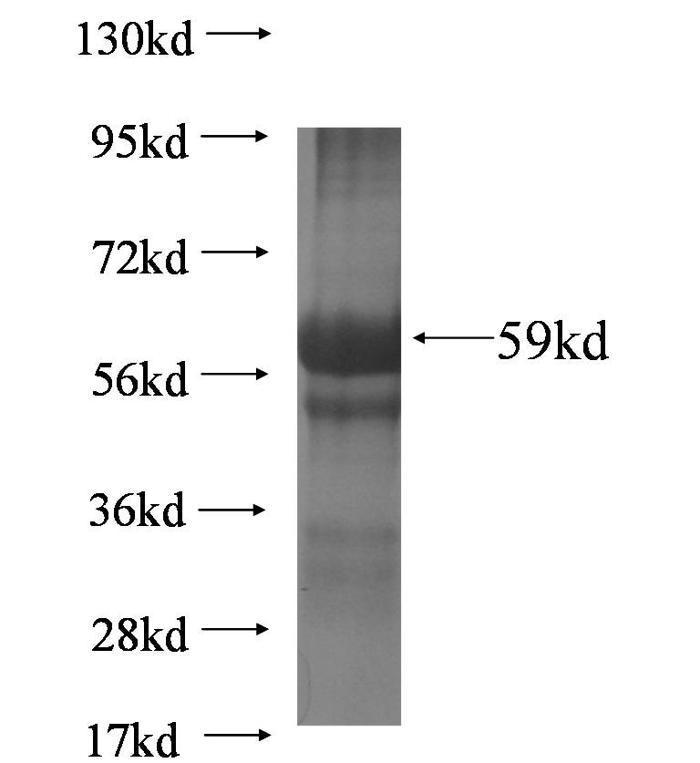 PPP1R3B fusion protein Ag5521 SDS-PAGE