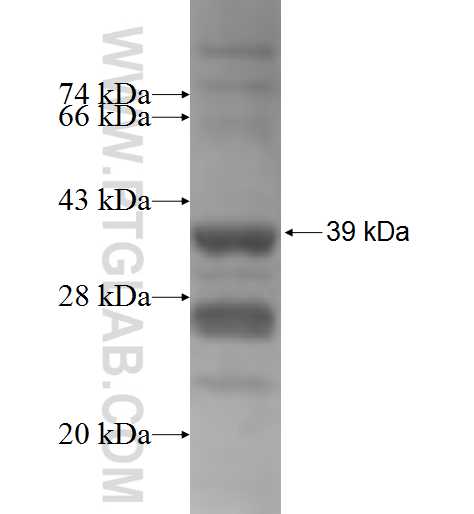 PPP1R3B fusion protein Ag5734 SDS-PAGE