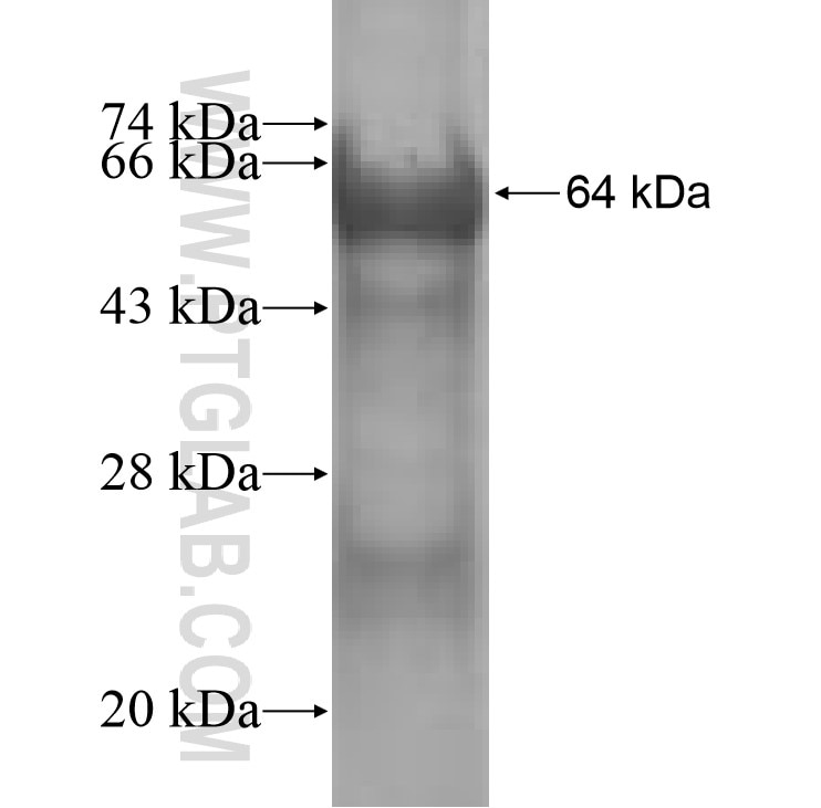 PPP1R3C fusion protein Ag9005 SDS-PAGE