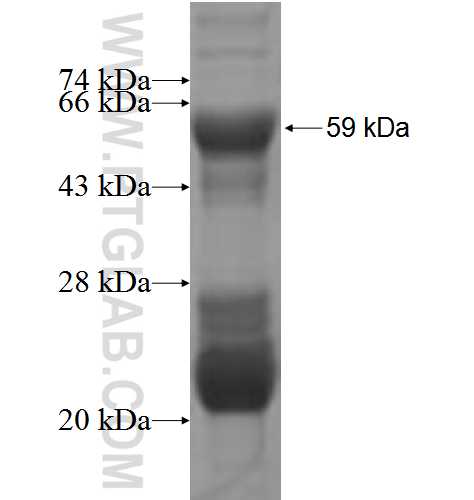PPP1R3D fusion protein Ag5091 SDS-PAGE