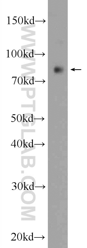 WB analysis of SMMC-7721 using 55386-1-AP