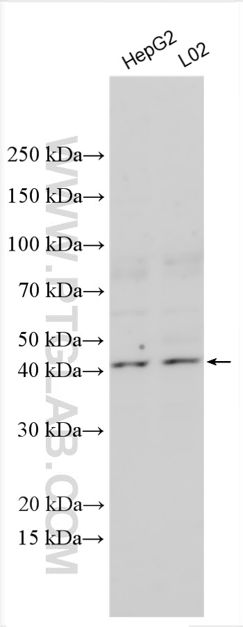 Western Blot (WB) analysis of various lysates using PPP1R3G Polyclonal antibody (55389-1-AP)