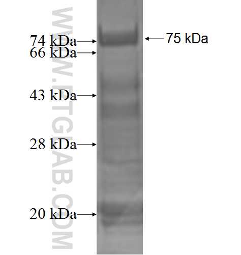 PPP1R7 fusion protein Ag2263 SDS-PAGE
