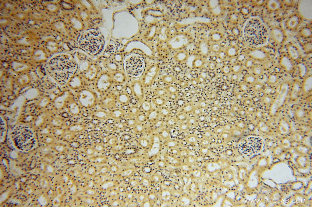 Immunohistochemistry (IHC) staining of human kidney tissue using PPP1R8 Polyclonal antibody (16115-1-AP)