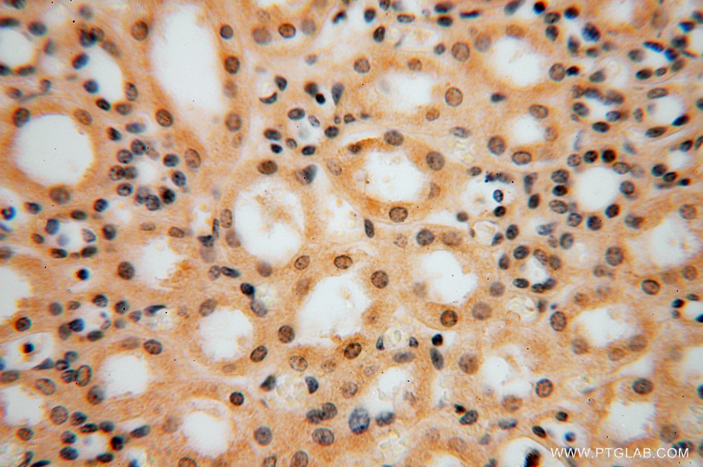 Immunohistochemistry (IHC) staining of human kidney tissue using PPP1R8 Polyclonal antibody (16115-1-AP)