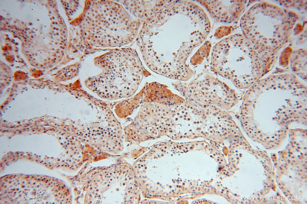 Immunohistochemistry (IHC) staining of human testis tissue using PPP1R8 Polyclonal antibody (16115-1-AP)