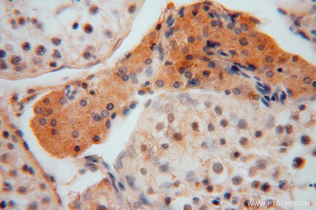 Immunohistochemistry (IHC) staining of human testis tissue using PPP1R8 Polyclonal antibody (16115-1-AP)