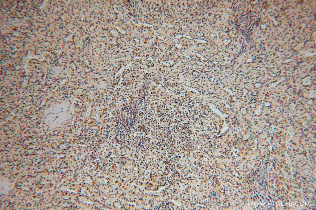 Immunohistochemistry (IHC) staining of human spleen tissue using PPP1R8 Polyclonal antibody (16115-1-AP)