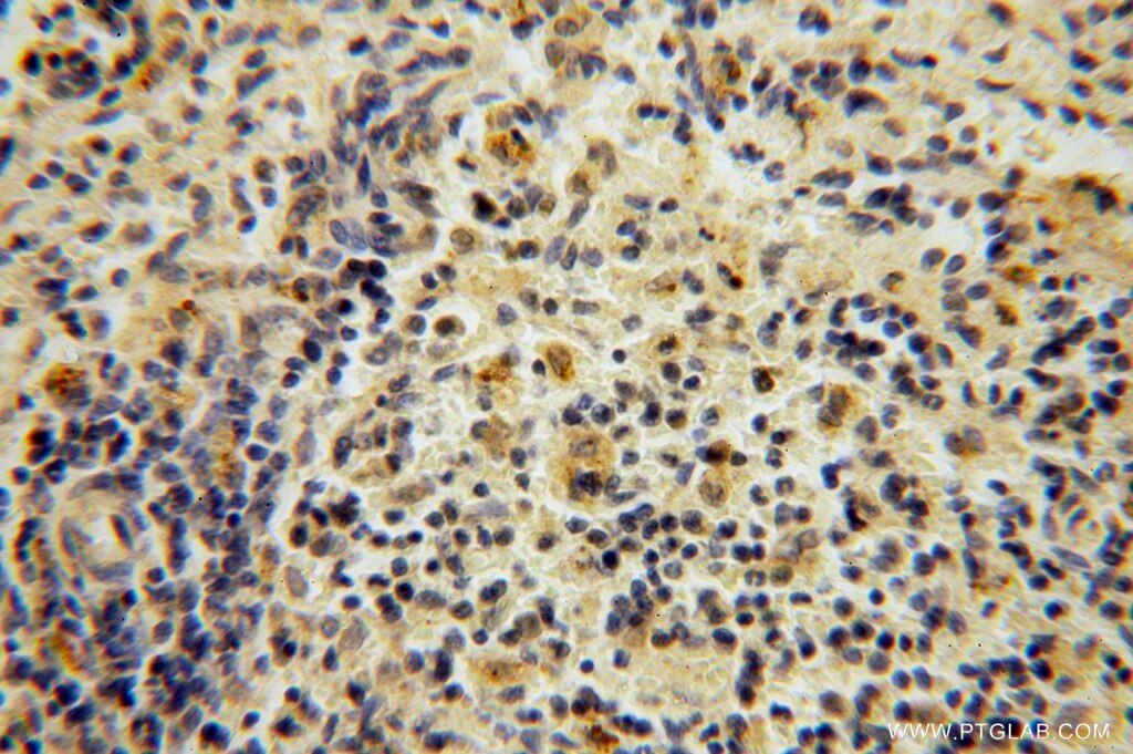 Immunohistochemistry (IHC) staining of human spleen tissue using PPP1R8 Polyclonal antibody (16115-1-AP)