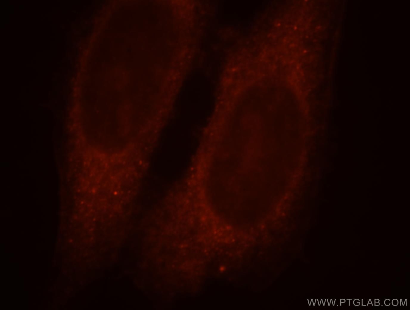 Immunofluorescence (IF) / fluorescent staining of HepG2 cells using PPP1R9A Polyclonal antibody (18801-1-AP)