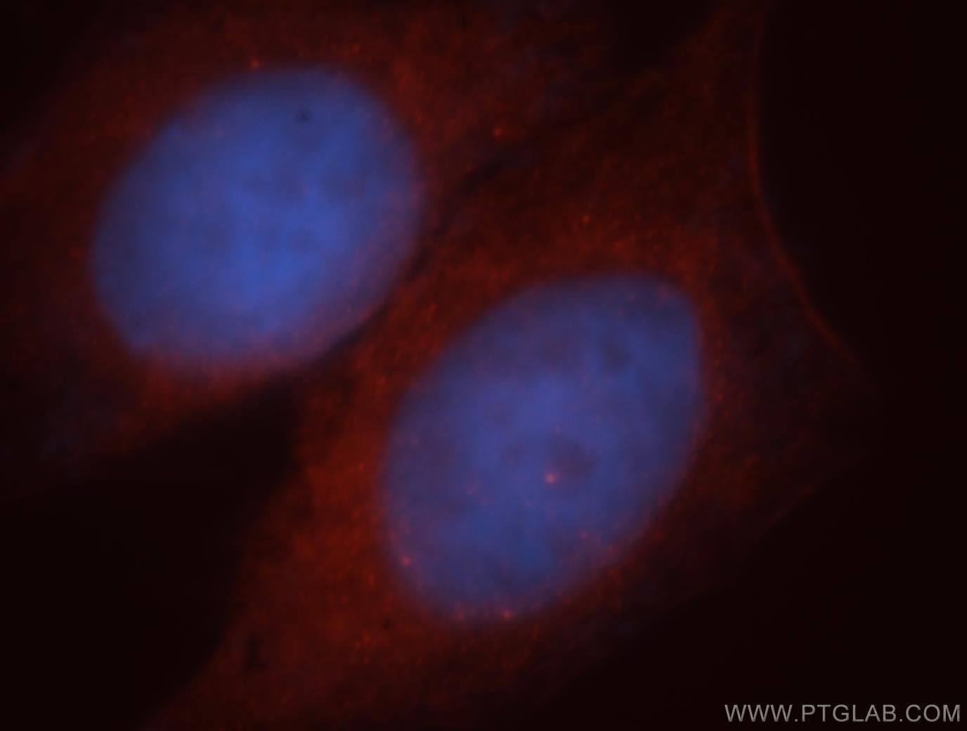 Immunofluorescence (IF) / fluorescent staining of HeLa cells using PPP1R9A Polyclonal antibody (18801-1-AP)
