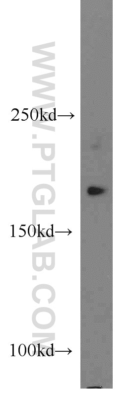 Western Blot (WB) analysis of PC-3 cells using PPP1R9A Polyclonal antibody (18801-1-AP)