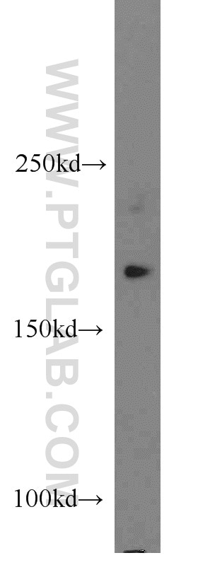 WB analysis of PC-3 using 18801-1-AP