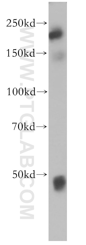 Western Blot (WB) analysis of PC-3 cells using PPP1R9A Polyclonal antibody (18801-1-AP)