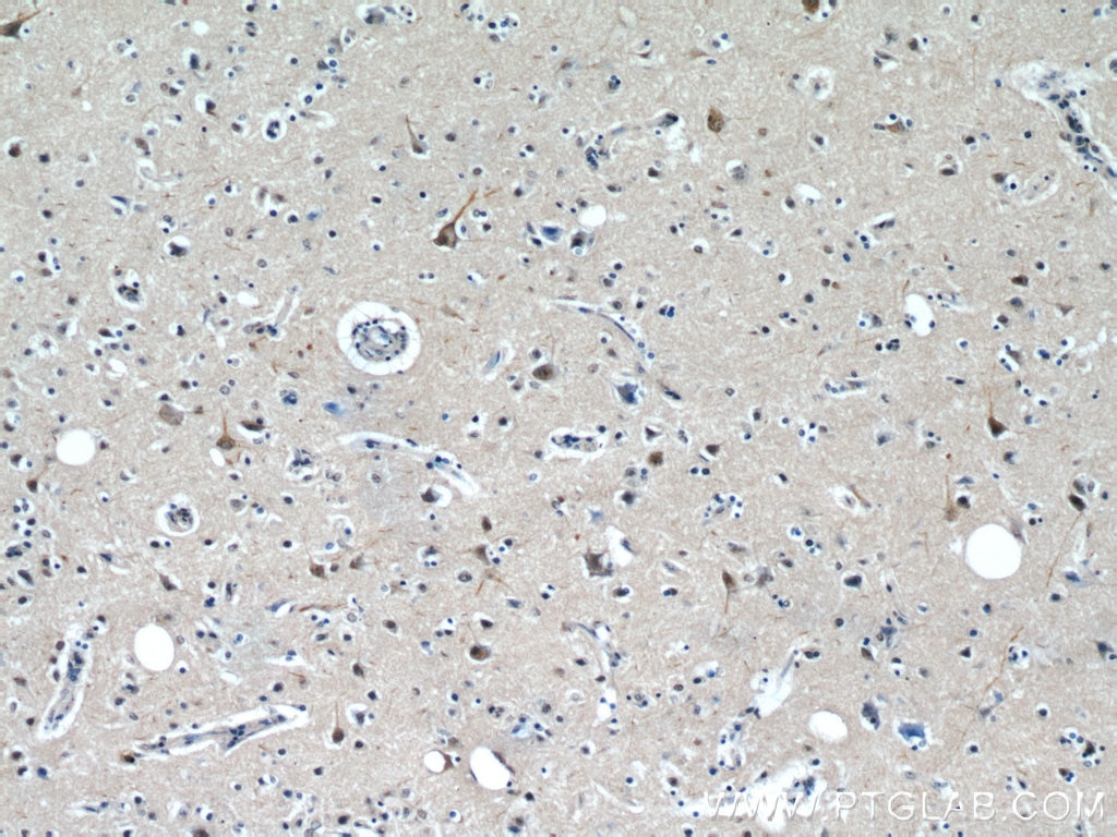 Immunohistochemistry (IHC) staining of human brain tissue using Neurabin 2 Polyclonal antibody (55129-1-AP)