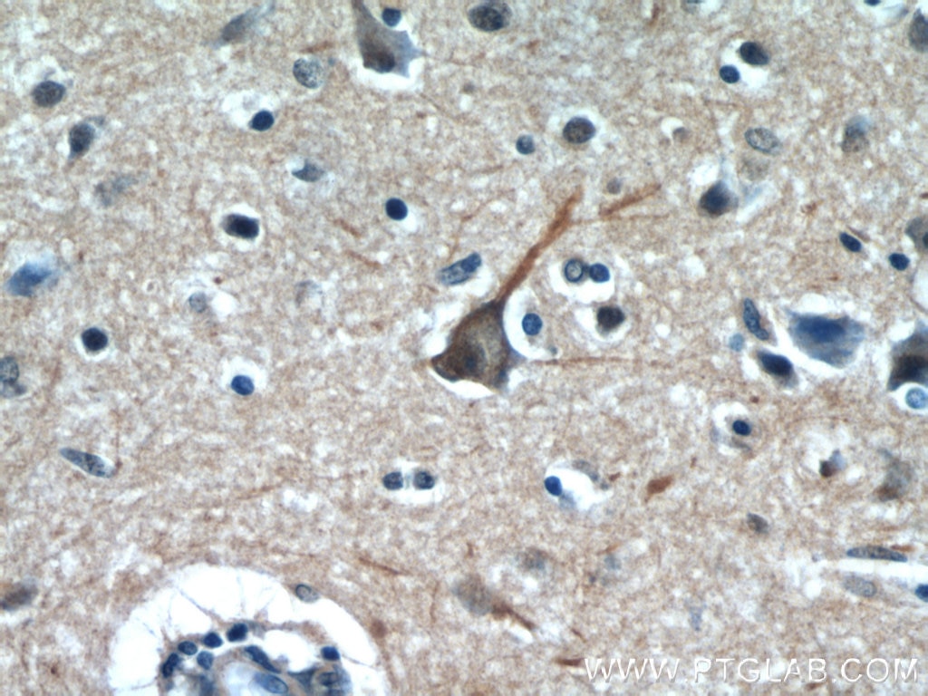 Immunohistochemistry (IHC) staining of human brain tissue using Neurabin 2 Polyclonal antibody (55129-1-AP)