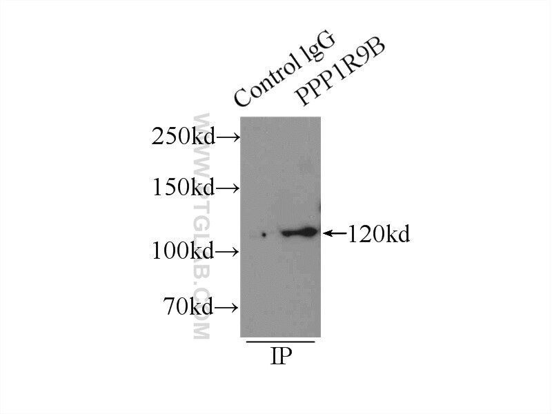 Immunoprecipitation (IP) experiment of mouse brain tissue using Neurabin 2 Polyclonal antibody (55129-1-AP)