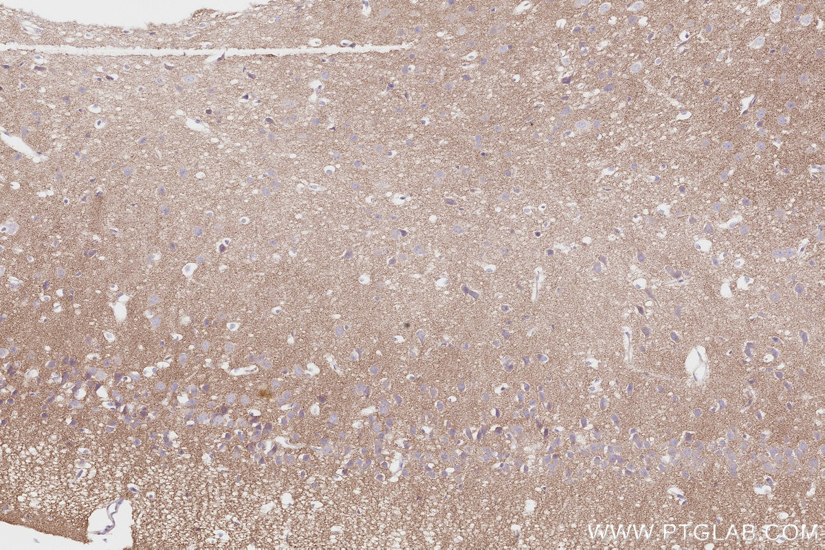 Immunohistochemistry (IHC) staining of mouse brain tissue using PPP1R9B Recombinant antibody (85198-1-RR)