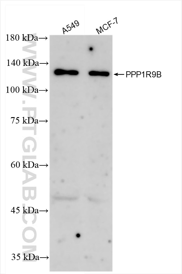 Western Blot (WB) analysis of various lysates using PPP1R9B Recombinant antibody (85198-1-RR)