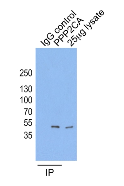 Immunoprecipitation (IP) experiment of Hela cells using PPP2CA Polyclonal antibody (13482-1-AP)